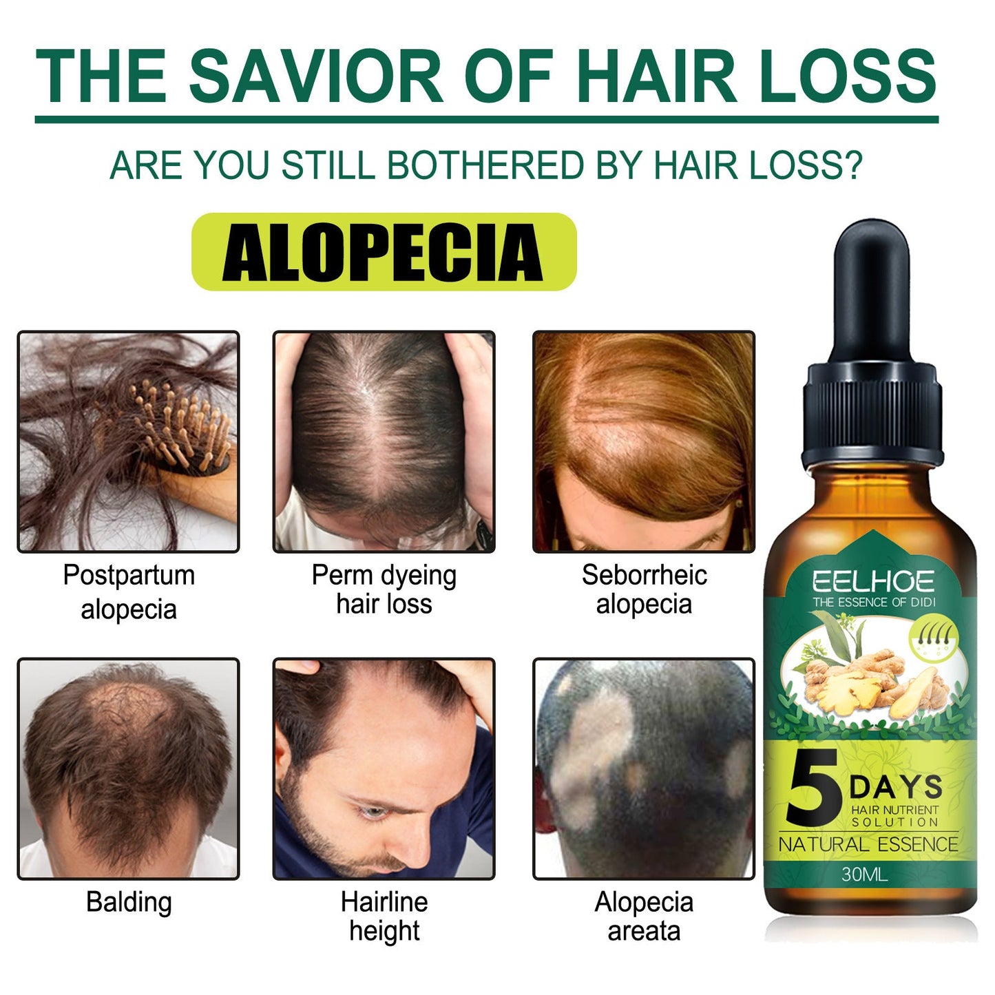 Eelhoe Ginger Hair Essential Oil. Eelhoe Ginger Hair Essential Oil eprolo