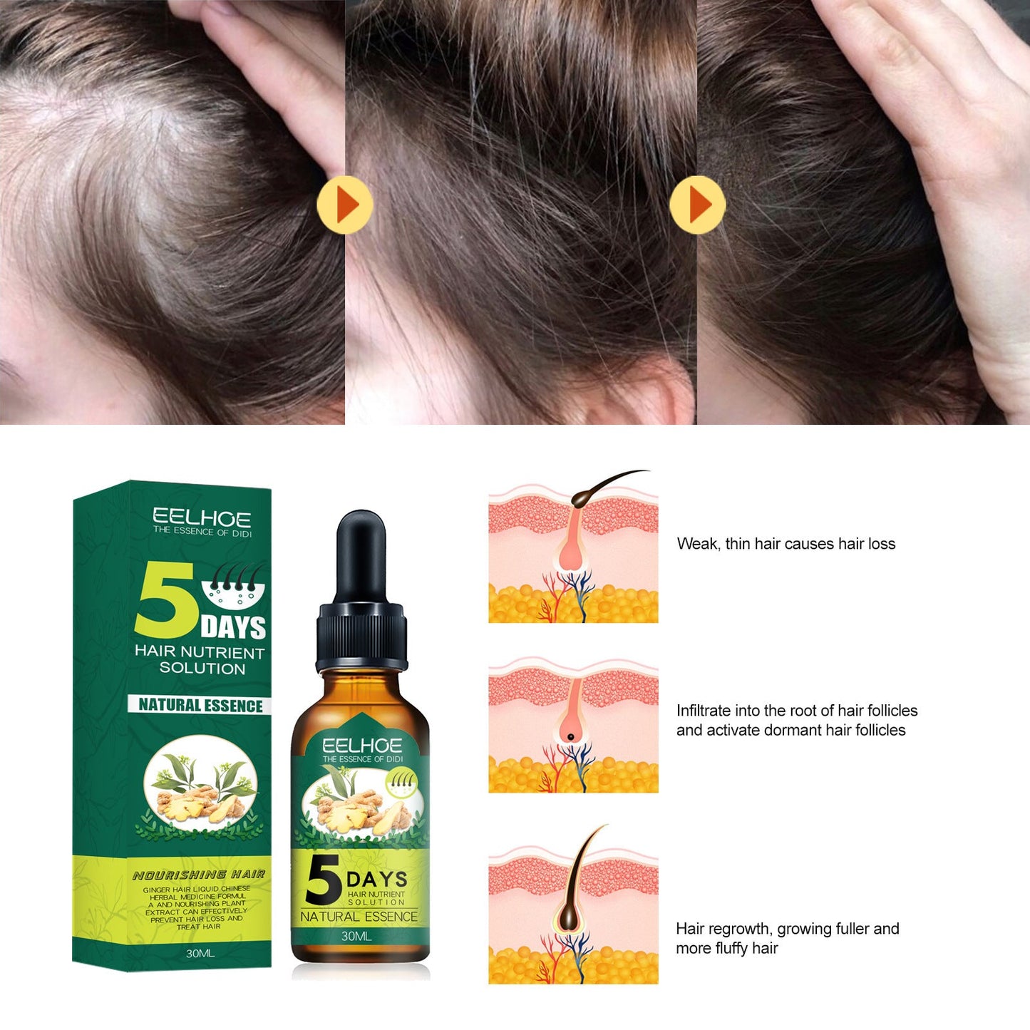 Eelhoe Ginger Hair Essential Oil. Eelhoe Ginger Hair Essential Oil eprolo