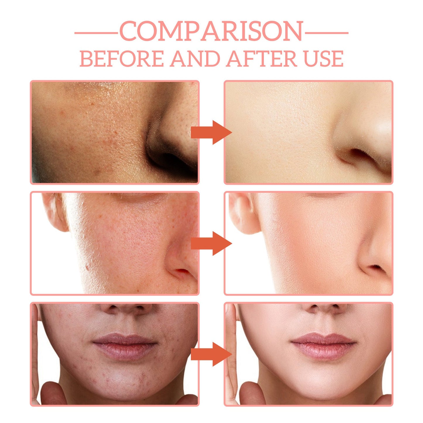 5 In 1 Facial Serum,30 Vitamin C Face Serum,Anti Aging Reduces Wrinkles Hydrating Collagen Facial Serum With Niacinamide,,Hyaluronic Acid, Vitamin E eprolo