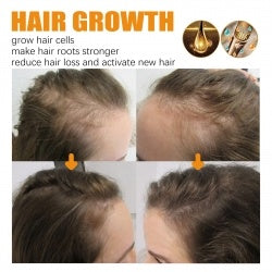 Biotin Hair Essential Oil eprolo