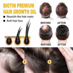 Biotin Hair Essential Oil eprolo