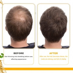 Biotin Hair Essential Oil eprolo