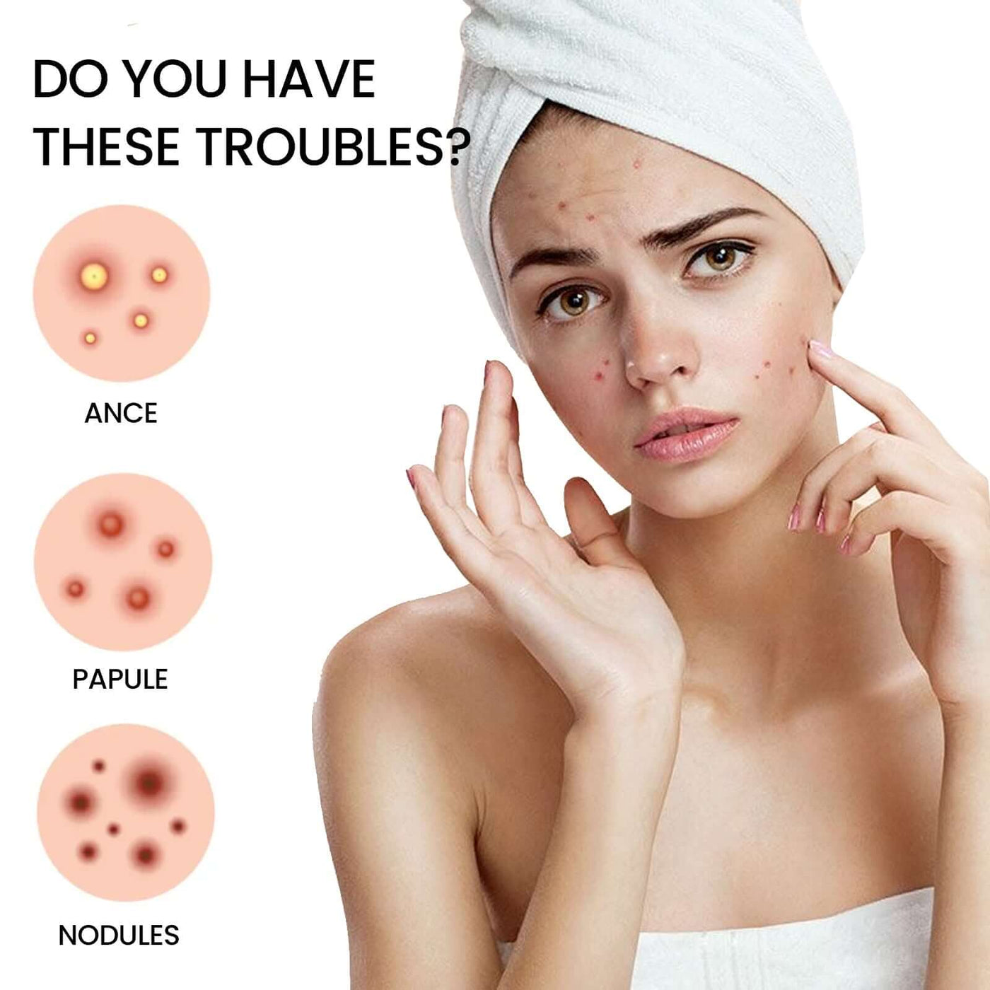 Acne Patch, Repair Facial Acne Invisible Concealer Hydrocolloid Patch eprolo