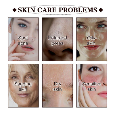 Black Tea Extract Cleansing Mask, Clean And Delicate Pore Brightening Skin Rejuvenating Daub Type Facial Mask eprolo