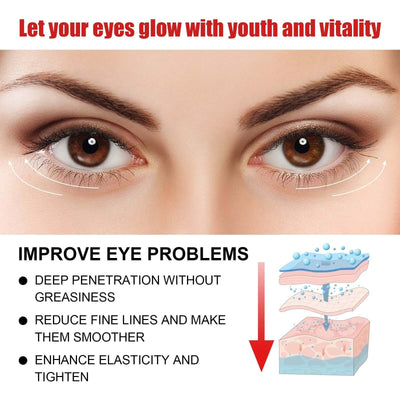 Nourishing And Moisturizing Eye Cream Keeps The Skin Around The Eyes Soft And Moisturized With A Gentle Daily Eye Cream eprolo