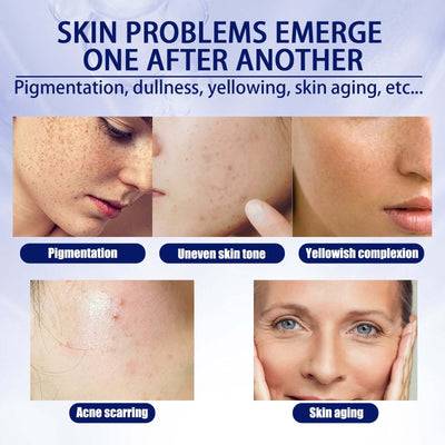 Anti-aging Vitamin C Facial Essence, Reduces Spots Acne Fine Lines, Moisturizes Facial Essence eprolo