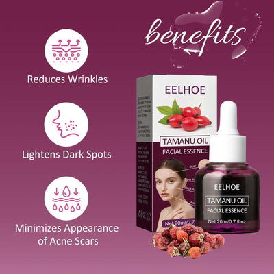 Tamanu Facial Oil, Relieves Acne Marks Fine Lines Moisturizes and Firms Skin Essential Oil eprolo
