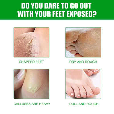 Aloe Vera Foot Mask, Moisturizing Anti-Cracking, Dead Skin Removal, Tender Skin Care Foot Mask eprolo