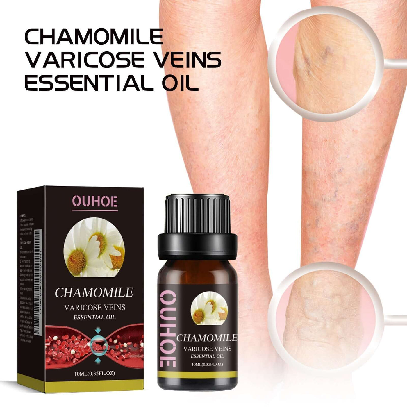 Chamomile Leg Essential Oil Protects Leg Skin And Relieves Leg Discomfort With Daily Massage Essential Oil eprolo