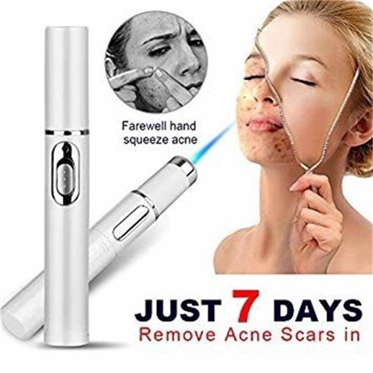 Blue light therapy acne laser pen for scar and wrinkle removal, effective skin care device for acne treatment.