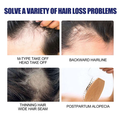 Men's Dense Hair Foam Machine, Repair Hair Root Follicle Men's Hair Thick Moisturizing Foam eprolo