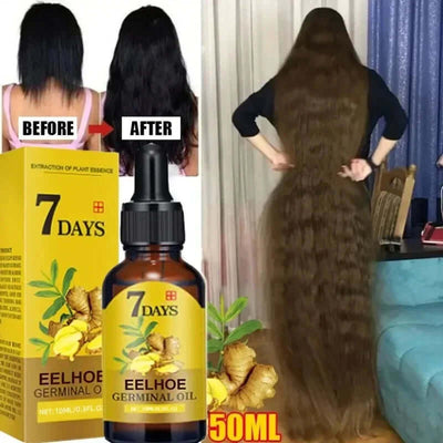 7 Day Fast Hair Growth Oil Ginger Growth Hair Treatment Anti Hair Loss Men Women Scalp Treatment Serum Products Beauty Product eprolo