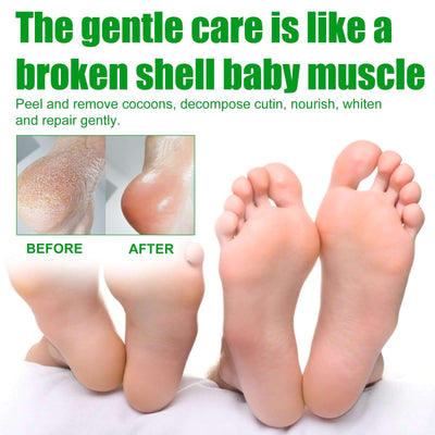 Aloe Vera Foot Mask, Moisturizing Anti-Cracking, Dead Skin Removal, Tender Skin Care Foot Mask eprolo