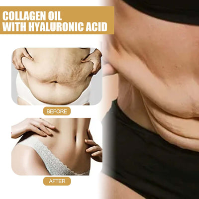 Firming Collagen Oil, Shows The Curves Of The Body, Firming Shaping And Slimming Body Essential Oil eprolo