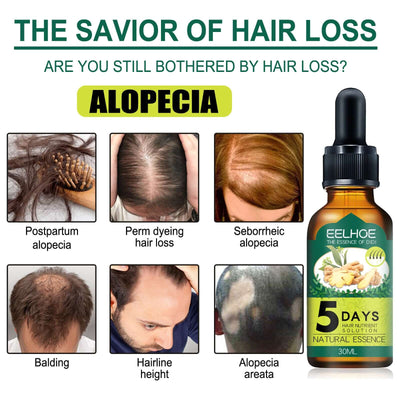Eelhoe Ginger Hair Essential Oil. Eelhoe Ginger Hair Essential Oil eprolo