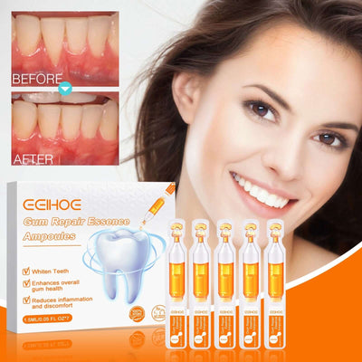 Tooth Repair Essence, Cleaning Teeth Stains Tartar Care Gums Oral Care Essence eprolo