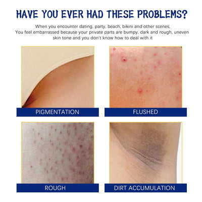 Body Whitening Cream, Lightening Dull Skin Even Skin Tone Moisturizing Skin Beauty Cream eprolo