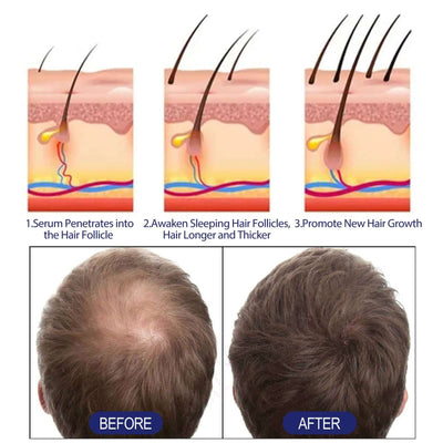 Men's Dense Hair Foam Machine, Repair Hair Root Follicle Men's Hair Thick Moisturizing Foam eprolo