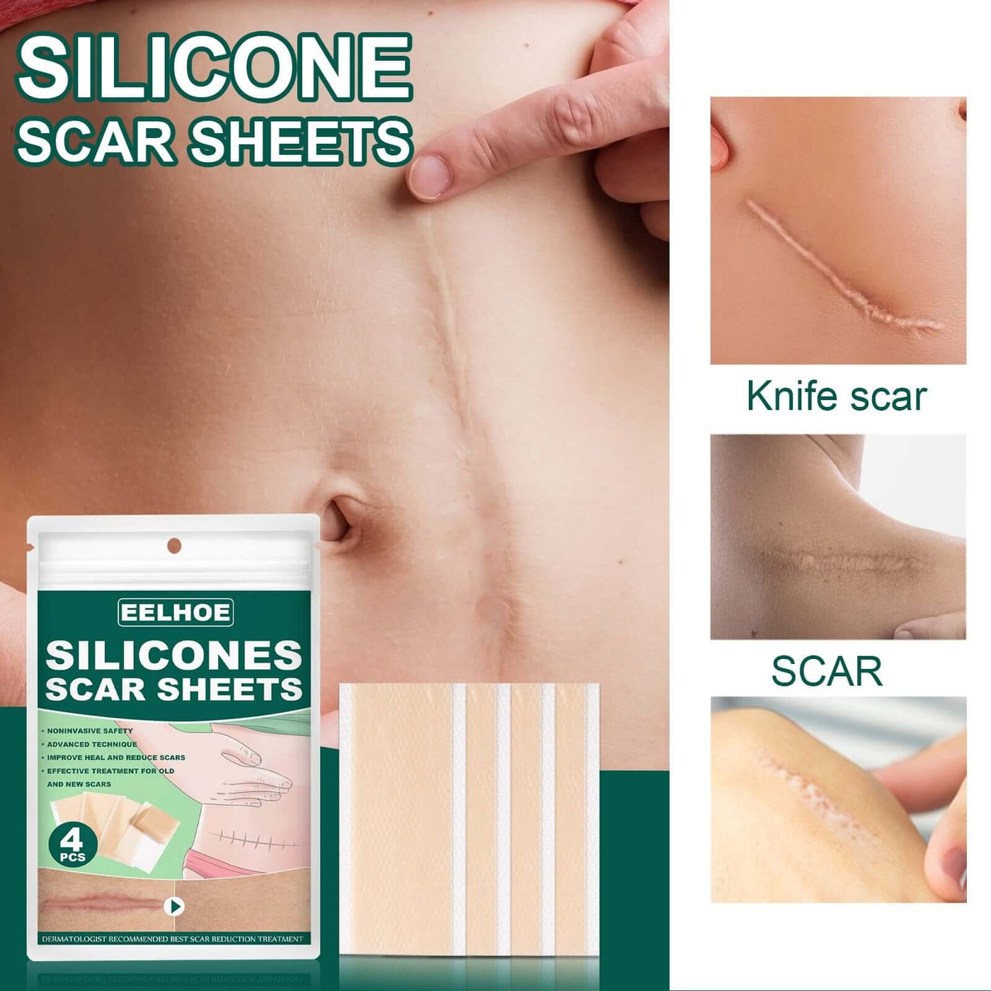 Silicone Gel Repair Patch, Fade Marks Transparent Care Skin Repair Patch eprolo