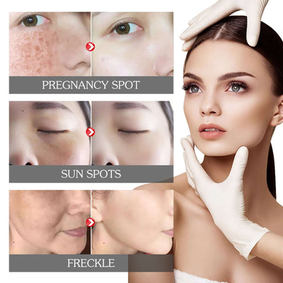 Face Brightening Serum, Lighten Dark Spots Moisturizing And Repairing Fine Lines Brightening Serum eprolo