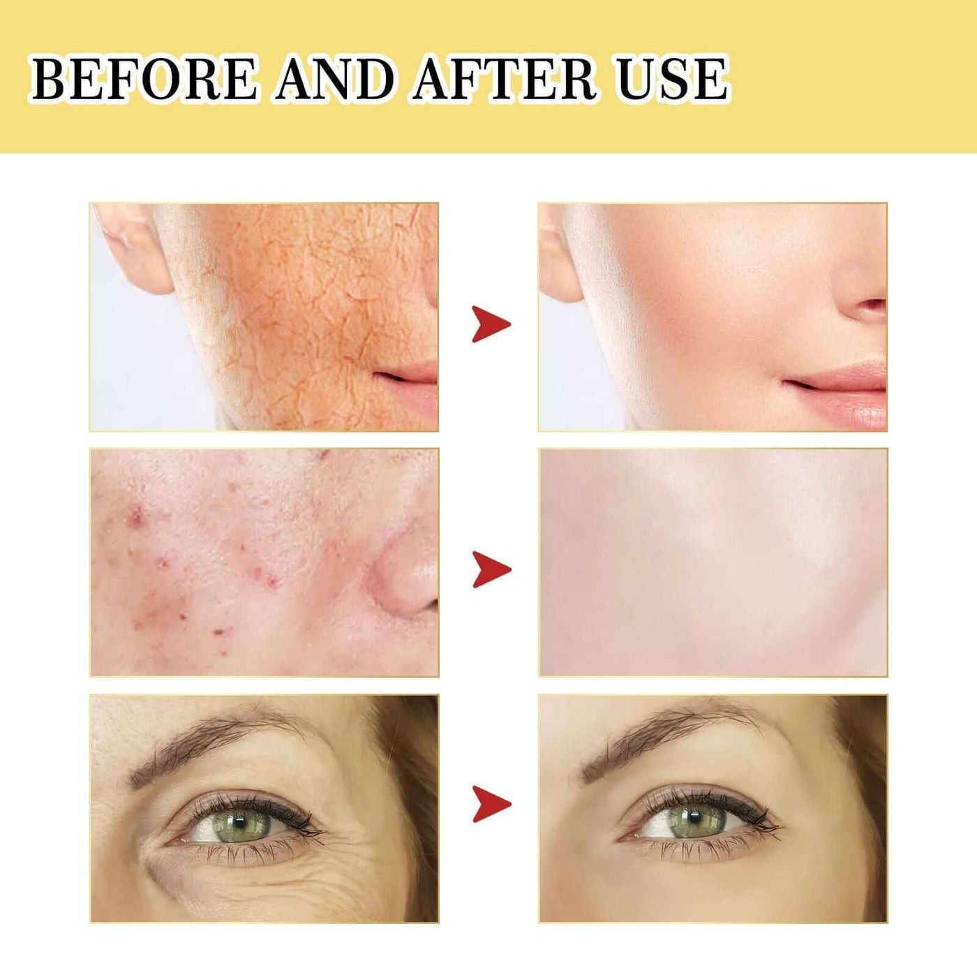 OUHOE Snail 96 Collagen Power Essence Repairs Skin Barrier, Moisturizes And Desalinates Black Spot Snail Essence eprolo