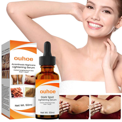 Skin Lightening Serum, Brightening Moisturizing Remove Black Skin Beauty Essence eprolo