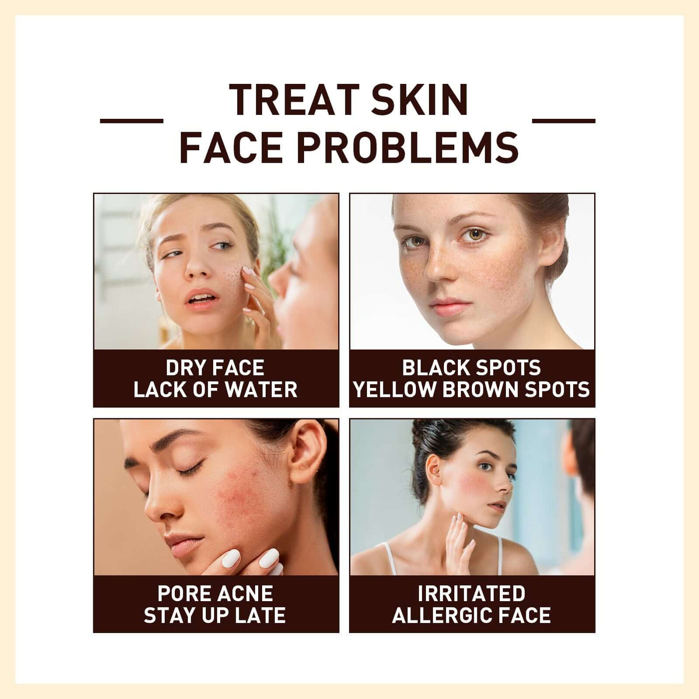 Rice Anti Wrinkle Essence, Repairs Skin Moisturizes Firms Whitens Essence eprolo