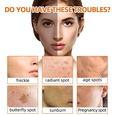 Turmeric Face Soap, Face Repair Gentle Cleansing, Fade Spots And Smooth Fine Lines Cleaner Soap eprolo