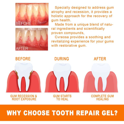 Tooth Repair Essence, Cleaning Teeth Stains Tartar Care Gums Oral Care Essence eprolo