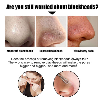 Black Pig Nose Patch, Bamboo Charcoal Remove Blackhead Acne Tear Nose Mask Patch eprolo