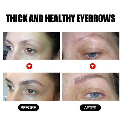 Eyebrow Liquid Dark Thick Natural Oil Eyebrow Repair Mild Moisturizing Treatment eprolo