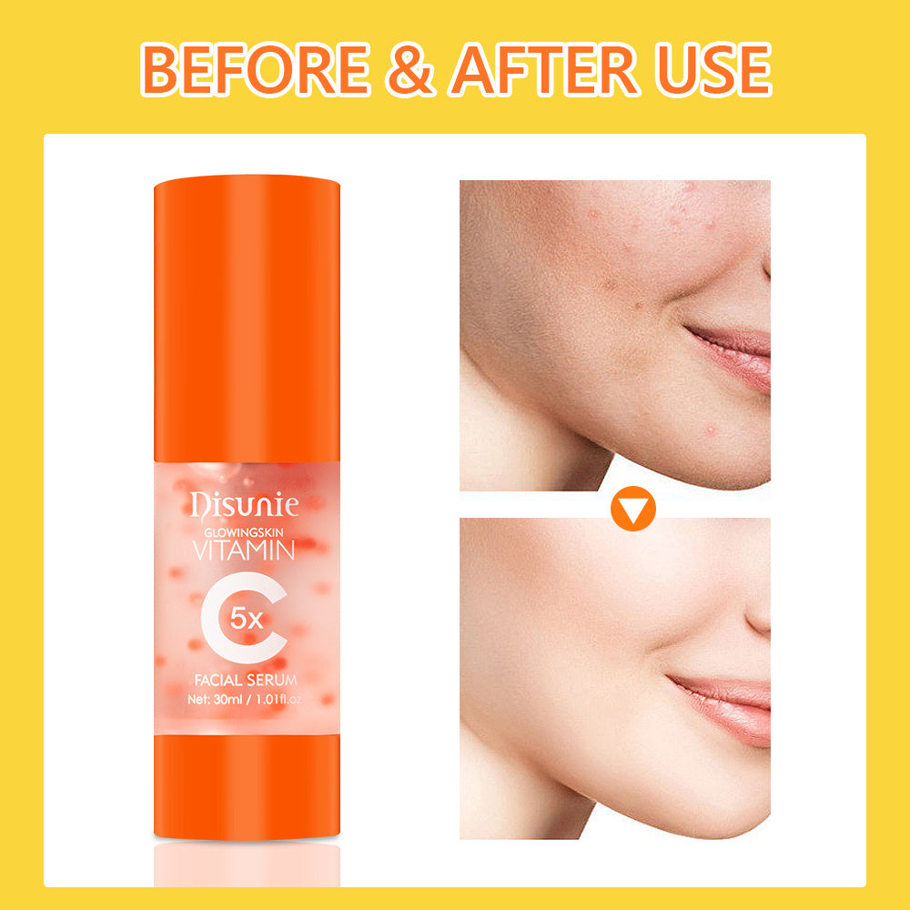 Vit C Face Serum Facial Whitening Brightening Hyaluronic Acid Collagen Vitamin C Dark Spot Corrector Anti-Aging Serums For Face eprolo