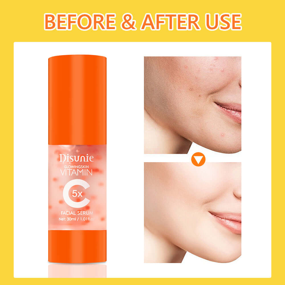 Vit C Face Serum Facial Whitening Brightening Hyaluronic Acid Collagen Vitamin C Dark Spot Corrector Anti-Aging Serums For Face eprolo