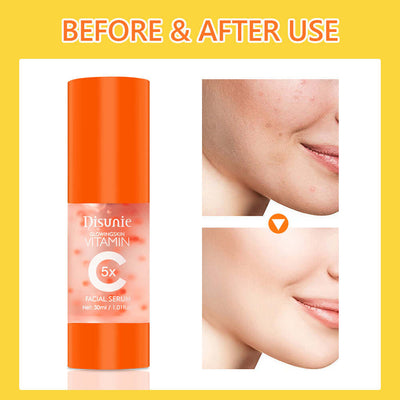 Vit C Face Serum Facial Whitening Brightening Hyaluronic Acid Collagen Vitamin C Dark Spot Corrector Anti-Aging Serums For Face eprolo