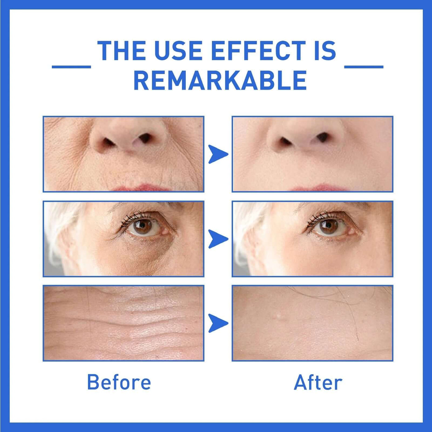 Anti-Aging Collagen Serum with Nicotinamide, Vitamin C, Hyaluronic Acid - Reduce Dark Spots, Cleanse & Tighten Skin eprolo