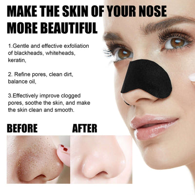 Black Pig Nose Patch, Bamboo Charcoal Remove Blackhead Acne Tear Nose Mask Patch eprolo