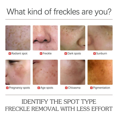 Face Brightening Serum, Lighten Dark Spots Moisturizing And Repairing Fine Lines Brightening Serum eprolo