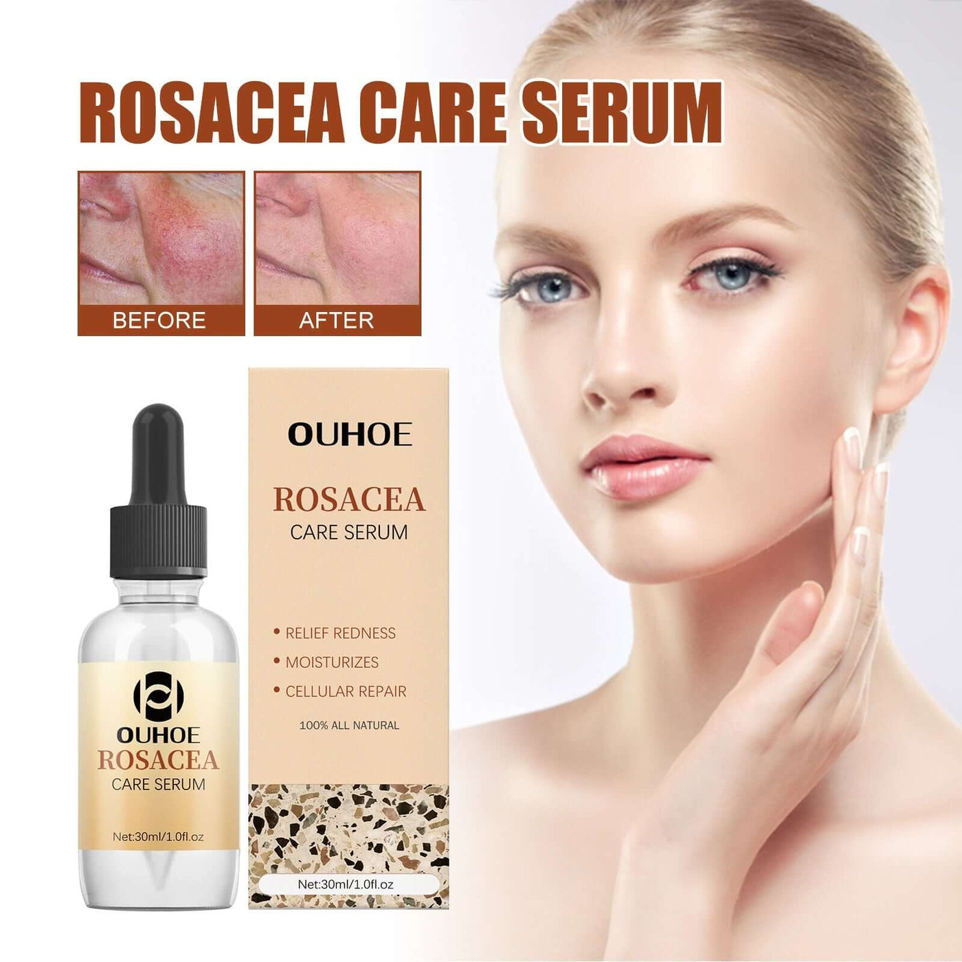Erythematous Repair Essence, Repair Skin Lighten Facial Erythematous Moisturizing Essential Oil eprolo