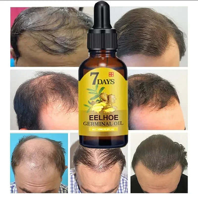 7 Day Fast Hair Growth Oil Ginger Growth Hair Treatment Anti Hair Loss Men Women Scalp Treatment Serum Products Beauty Product eprolo