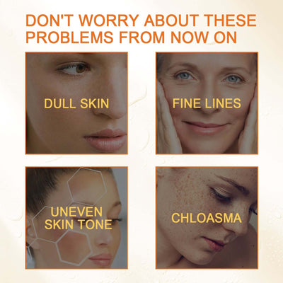 Skin Melanin Repair Essence, Brightening And Repairing Skin Removing Darkening And Dark Spots Hydrating Essence eprolo