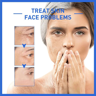 Anti-Aging Collagen Serum with Nicotinamide, Vitamin C, Hyaluronic Acid - Reduce Dark Spots, Cleanse & Tighten Skin eprolo