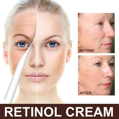Retinol Cream, Anti-Aging Firming Brightening Moisturizing Facial Skin Care Cream eprolo