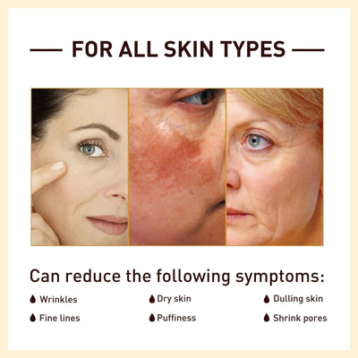 Rice Anti Wrinkle Essence, Repairs Skin Moisturizes Firms Whitens Essence eprolo
