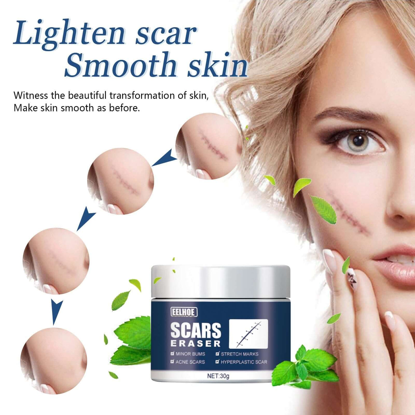 Scar Balm, Surgery Scar Repair Cold Compress Scar Skin Scar Gel Balm eprolo