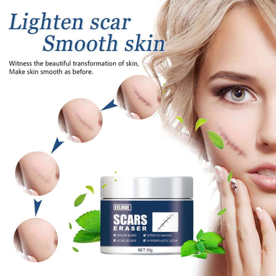 Scar Balm, Surgery Scar Repair Cold Compress Scar Skin Scar Gel Balm eprolo