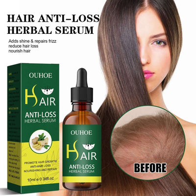 Dense Hair Essential Oil, Smooth Hair Repair Hair Root Thickening And Strengthening Hair Essence eprolo