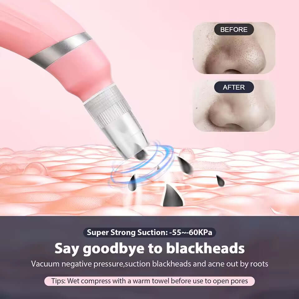 Diamond micro carving pore cleaner removes dead skin with high suction microcrystalline skin rejuvenation beauty device eprolo