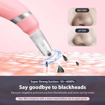 Diamond micro carving pore cleaner removes dead skin with high suction microcrystalline skin rejuvenation beauty device eprolo
