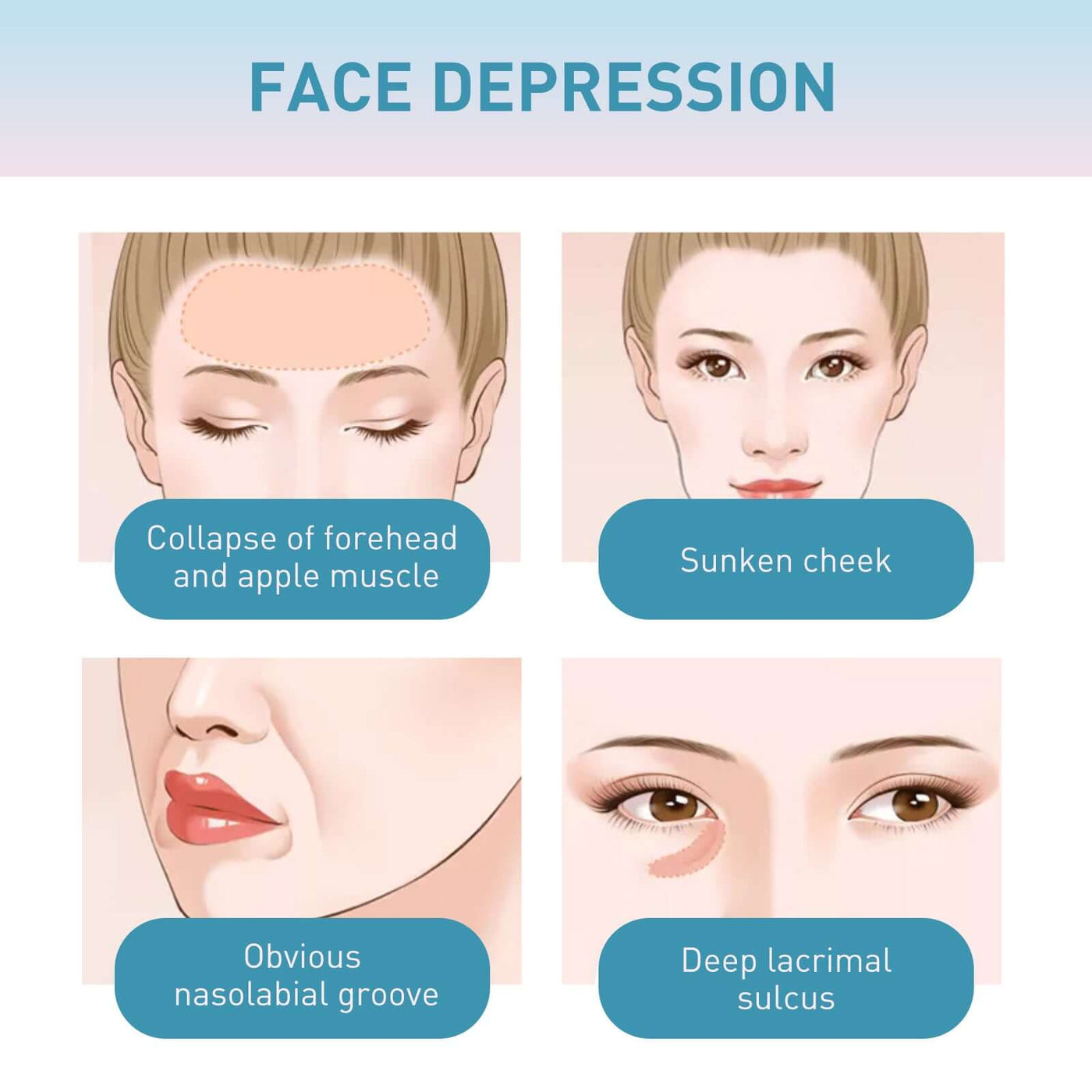 Collagen Anti-Wrinkle Cream, Moisturizes Tightens Tender Skin And Anti-aging Face Cream eprolo
