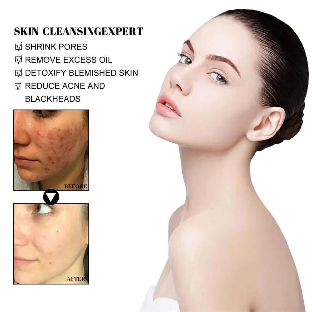 West & Month Blackhead Remove Solid Mud Film Refreshing Skin Cleaning Face Mask Moisturize Control Oil Shrink Pores Skin Care eprolo